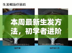 初学者进阶指南，掌握本周最新生发方法的详细步骤与技巧